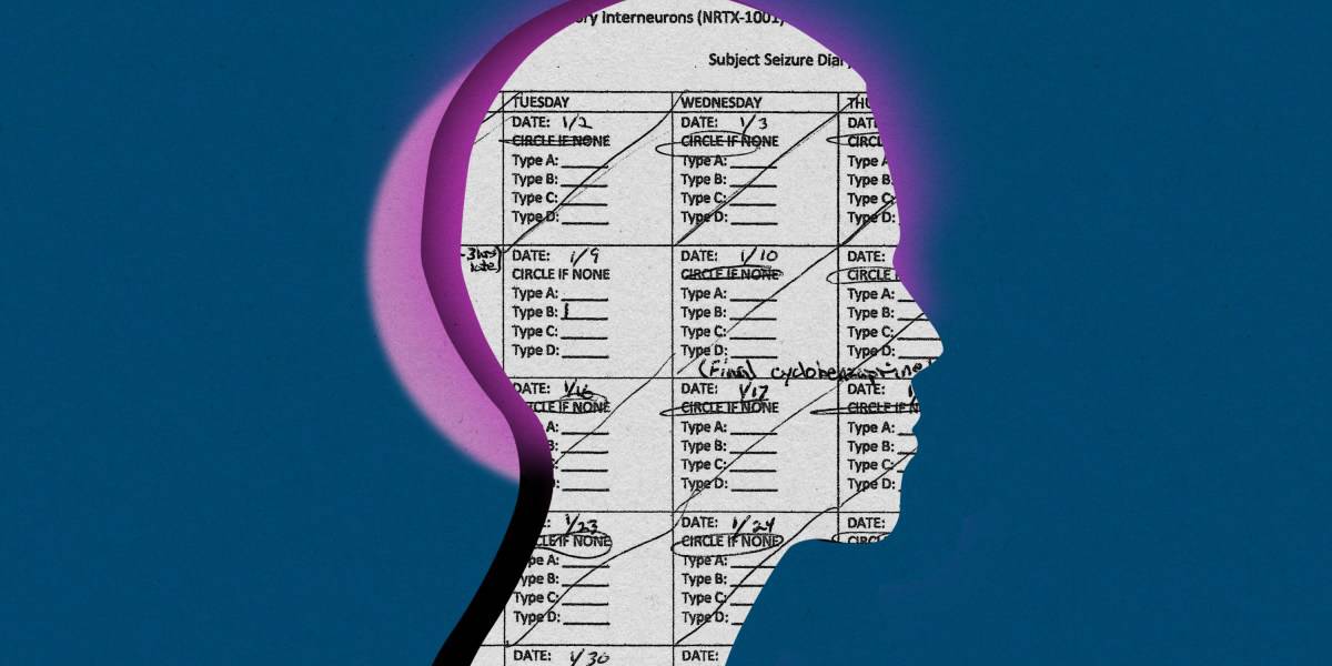 Mind-cell transplants are the latest experimental epilepsy medicine