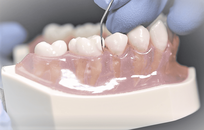 dental hygiene instrumentation process control instrumentation 16 hour masterclass