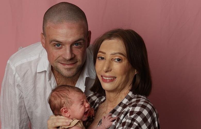 Burns Survivor Marks First Mother’s Day With Newborn | Mirage News