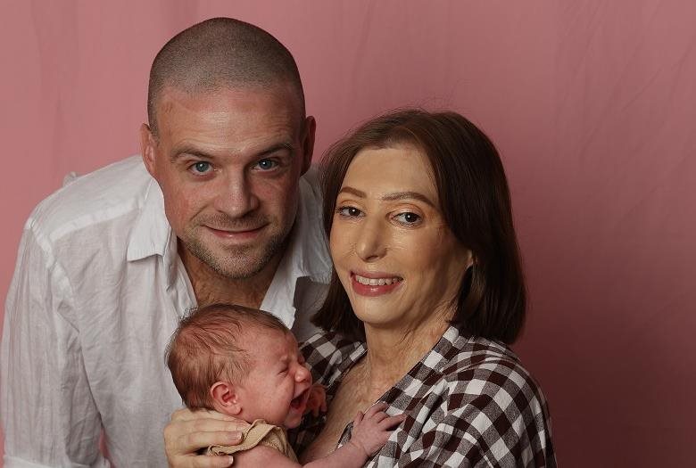 Burns Survivor Marks First Mother’s Day With Newborn | Mirage News