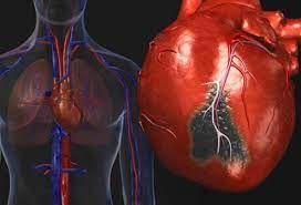 Cardiologist Lists Factors Contributing To Unhealthy Heart Function